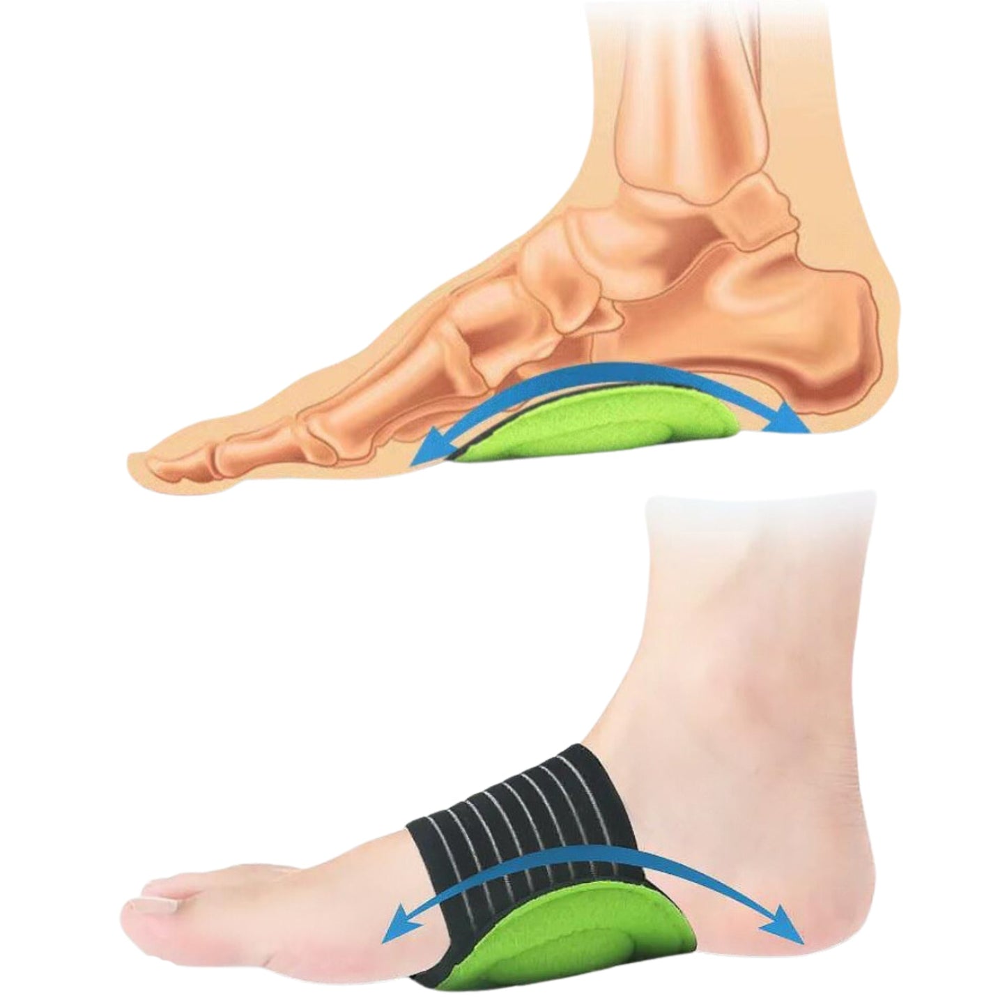 Springer Arch Support Brace (VIP CLUB)